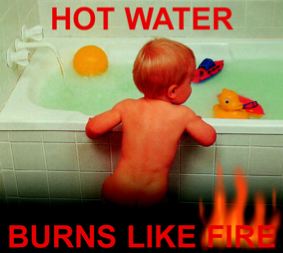 hot water burns